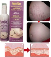 Ignite Mother Care Lotion